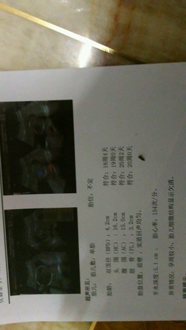journal_insert_pic_361165277