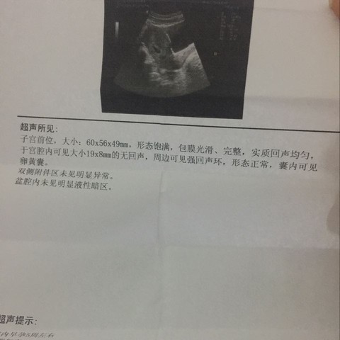 journal_insert_pic_361248738