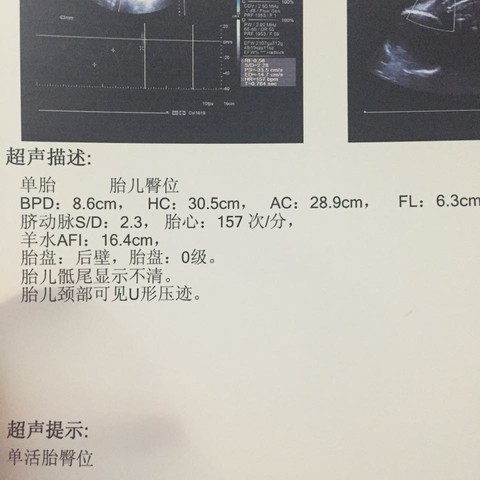journal_insert_pic_362436660