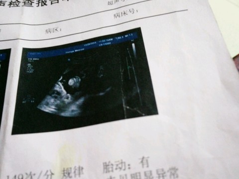 journal_insert_pic_371626893