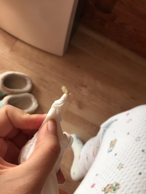 掏出一个巨大鼻屎