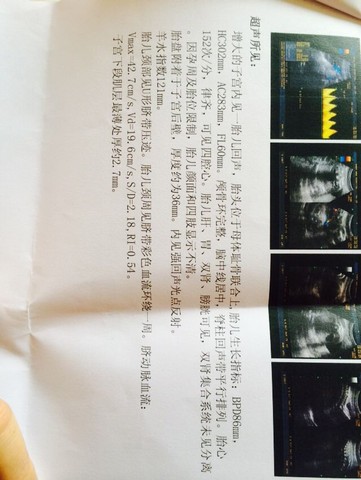 journal_insert_pic_380039802