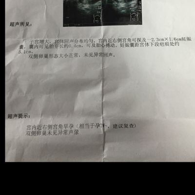 journal_insert_pic_380352238