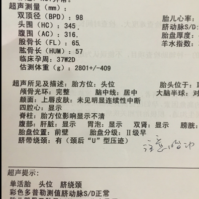 我怀孕37周了.昨天去做检查.说宝宝头大腿短.不排除有畸形.