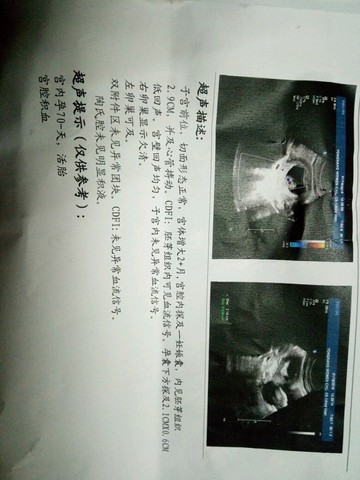 journal_insert_pic_390462626