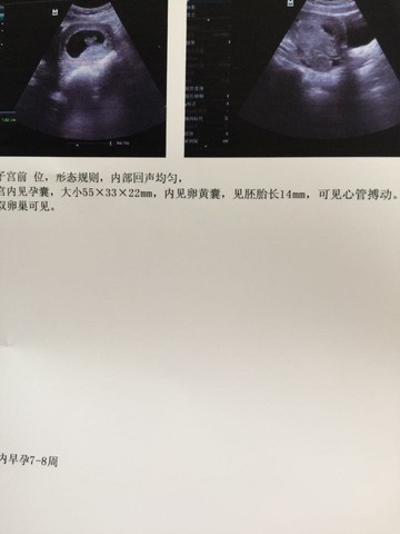 journal_insert_pic_390941592