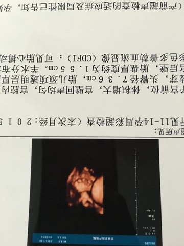 journal_insert_pic_391491686