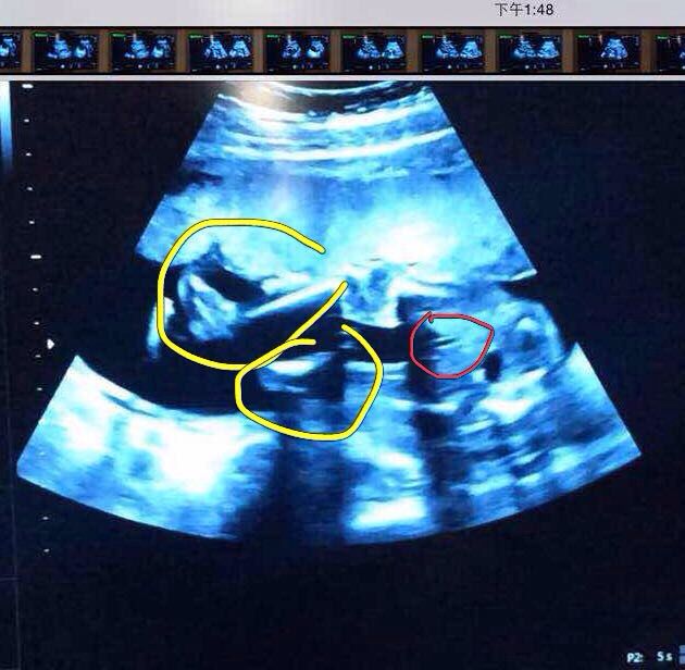 【四维】看男女_今天做四维归来,从视频上截图了两张宝宝图片,_宝宝树