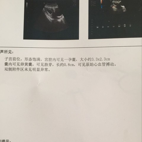 journal_insert_pic_395793566