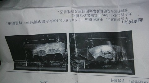 journal_insert_pic_396154759