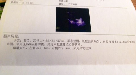 journal_insert_pic_398302192