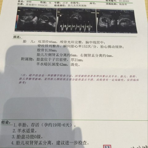 journal_insert_pic_399931317