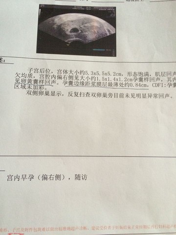 journal_insert_pic_400432649