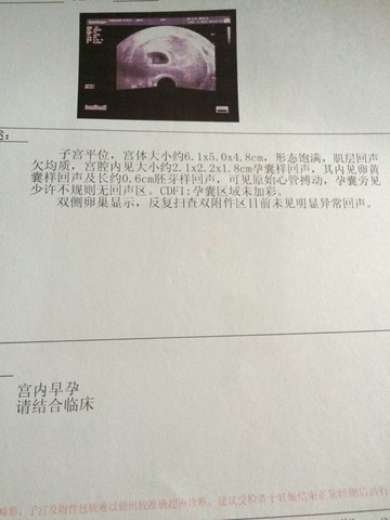 journal_insert_pic_400432661