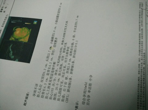 journal_insert_pic_401231792