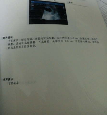 journal_insert_pic_401426378