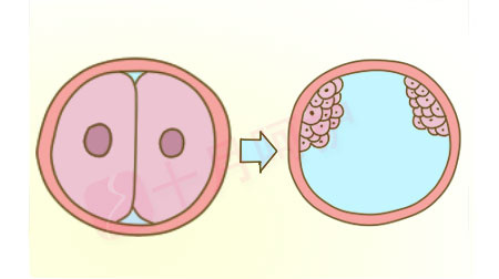 也就是在受精后的第4~8天,就会形成双羊膜囊单绒毛膜单胎盘的双胞胎