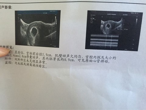 journal_insert_pic_408159084