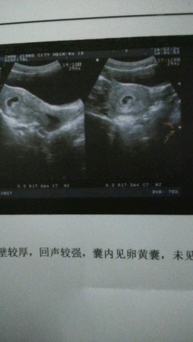 journal_insert_pic_412256446