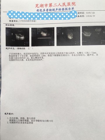 journal_insert_pic_414180840