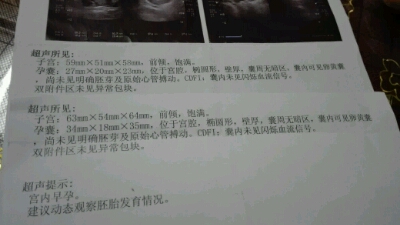 journal_insert_pic_415341069