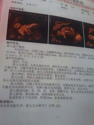 journal_insert_pic_415108282