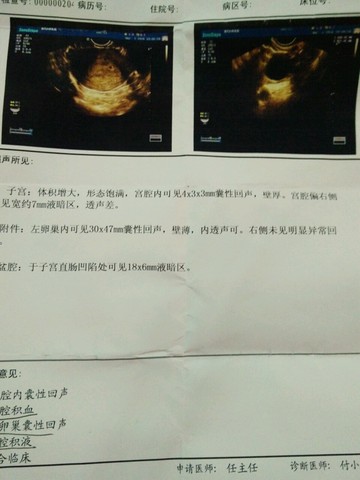 journal_insert_pic_416612403
