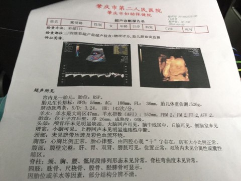journal_insert_pic_417334083