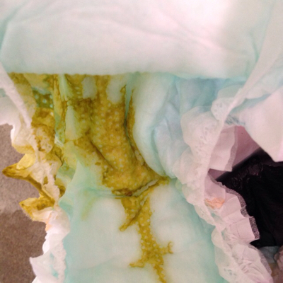 宝宝7个月,最近一周老是吃完奶就拉粑粑,拉的量也不多,一天要啦四次