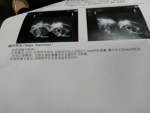 journal_insert_pic_421876604
