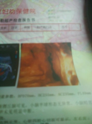 journal_insert_pic_424324805