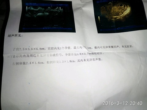 journal_insert_pic_424864235