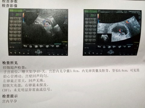 journal_insert_pic_424831594