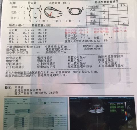 journal_insert_pic_429886942