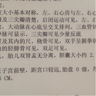 做四维 医生说孩子三尖瓣可见少量反流这个问题严重吗?