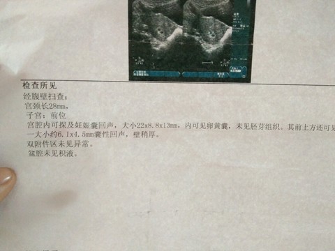 journal_insert_pic_429565962