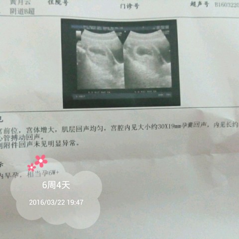 journal_insert_pic_432650354