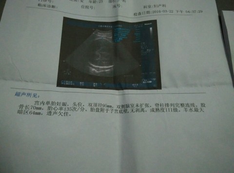 journal_insert_pic_432711437
