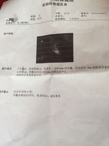 journal_insert_pic_432338924