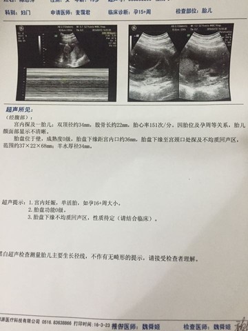 journal_insert_pic_433686717