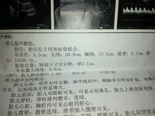 journal_insert_pic_437916701