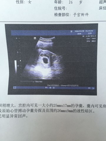 journal_insert_pic_438023720