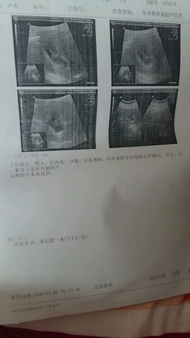 journal_insert_pic_440632421