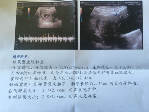 journal_insert_pic_441665429