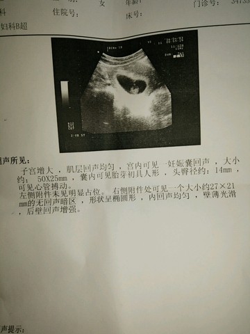 journal_insert_pic_443315478