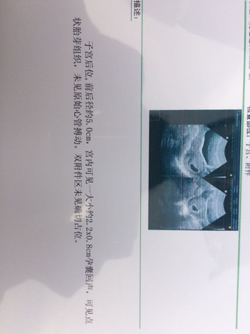 journal_insert_pic_443904673