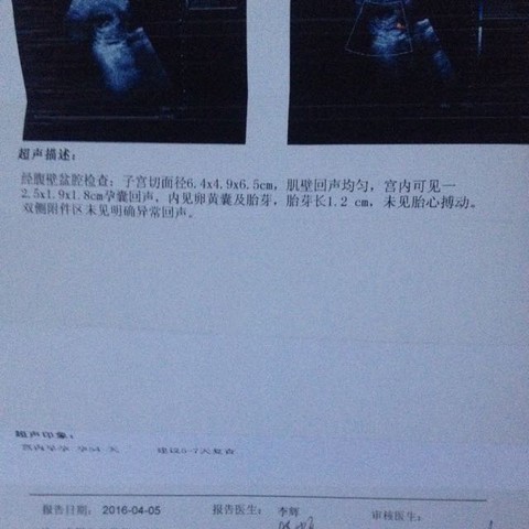 journal_insert_pic_444978168