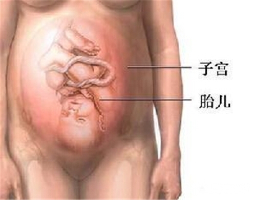 journal_insert_pic_444583518
