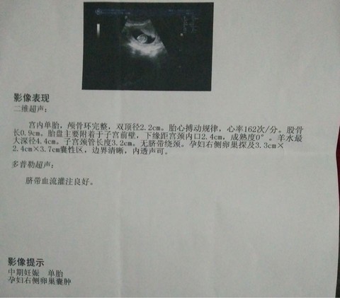 journal_insert_pic_445863591