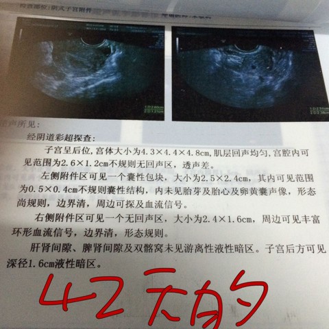 journal_insert_pic_445808531